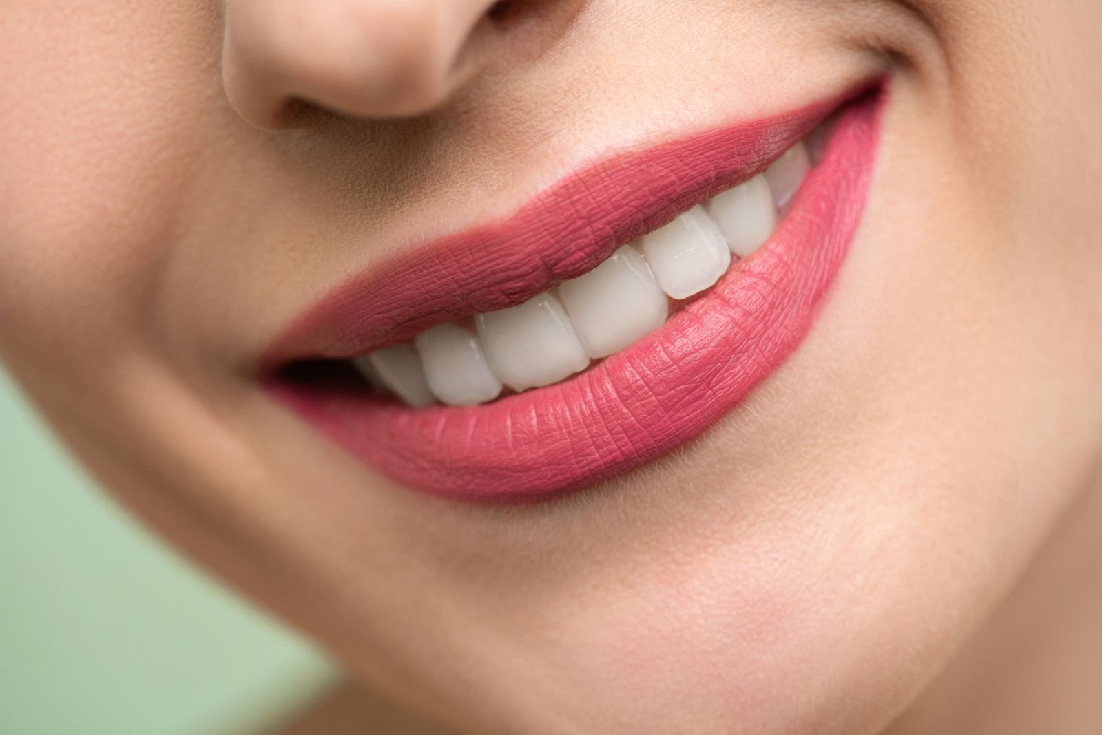 Hollywood smile in Peshawar: veneers, whitening, and what “white” should mean